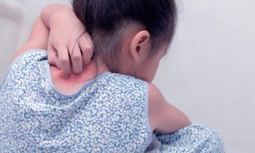 Ако Вие сте родител на дете с псориазис – това е за Вас!