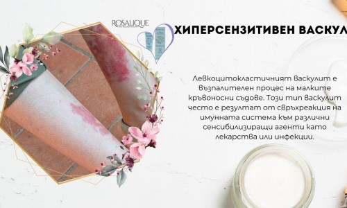 Хиперсензитивен васкулит