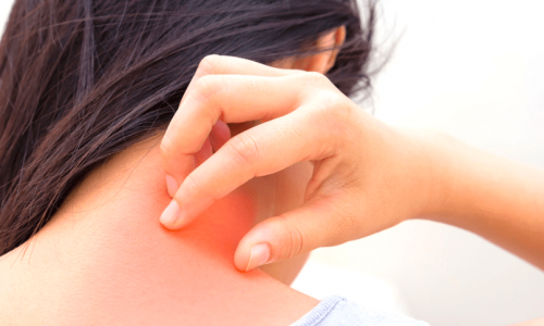 Когато лекарят постави диагноза псориазис