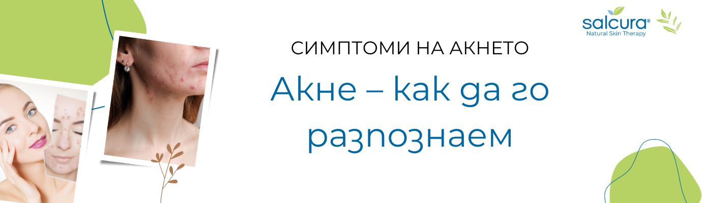 Кои са симптомите на акнето? Кои са симптомите на акнето?