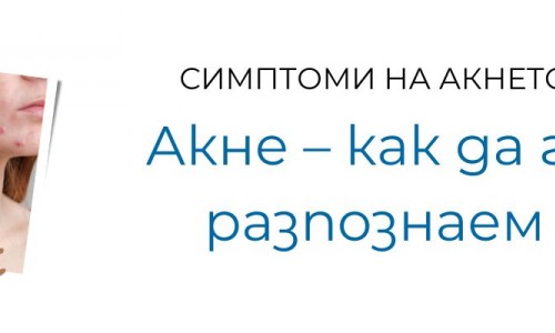 Кои са симптомите на акнето?
