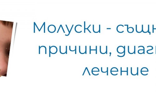 Молуски - същност, причини, диагноза, лечение