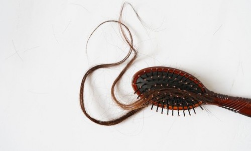 Най-често срещаните митове за пърхота