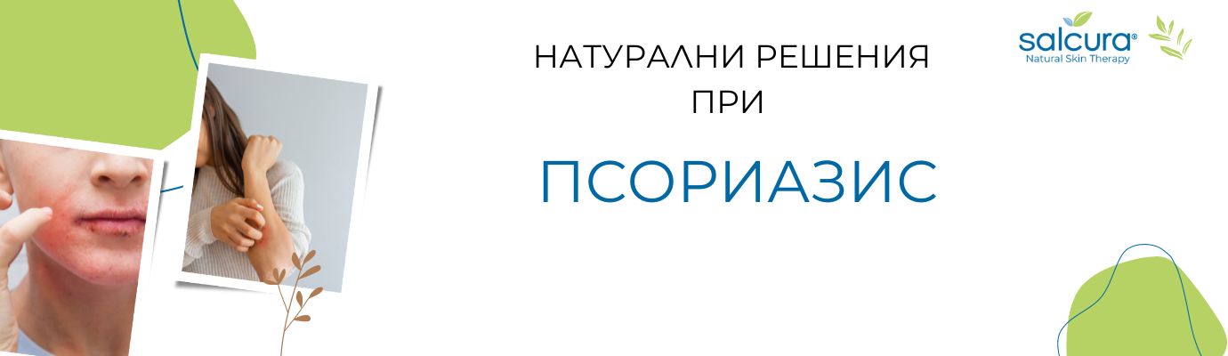 Псориазис - същност, причини, симптоми и лечение