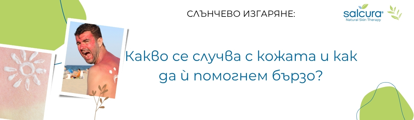 Слънчево изгаряне: Какво се случва с кожата и как да ѝ помогнем бързо? Слънчево изгаряне: Какво се случва с кожата и как да ѝ помогнем бързо?
