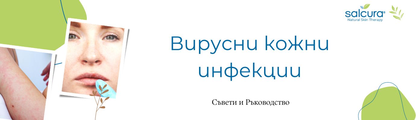 Вирусни кожни инфекции