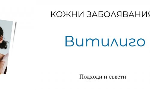 Витилиго - кожно заболяване
